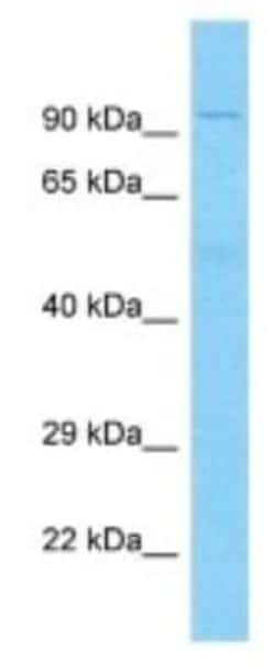 DUX4 Rabbit anti-Human, Polyclonal, Novus Biologicals 100 &mu;g; Unconjugated:Antibodies,
